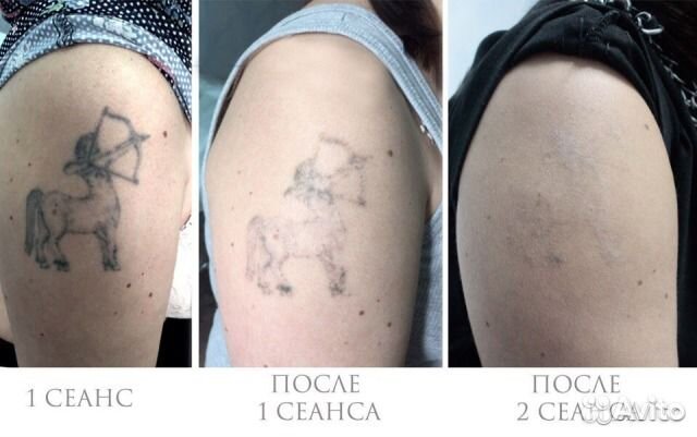 Плетение на пальцах. дёрганье Плетение на пальцах. дёрганье